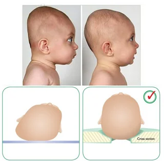 بالش فرمدهی